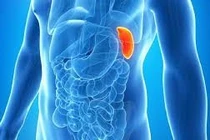 Người đàn ông 48 tuổi mắc u lách hiếm gặp