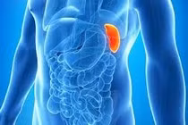 Người đàn ông 48 tuổi mắc u lách hiếm gặp