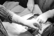 Giành lại sự sống cho nam thanh niên bị thương nghiêm trọng ở bụng