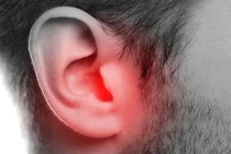 Phẫu thuật kịp thời giúp bảo vệ thính lực trẻ mắc cholesteatoma