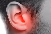 Phẫu thuật kịp thời giúp bảo vệ thính lực trẻ mắc cholesteatoma