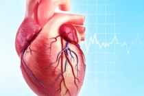 Cứu sống cô gái với u nhầy tim thất trái hiếm gặp