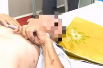 Bệnh nhân ở Bắc Ninh nguy kịch vì chó cắn không tiêm phòng