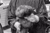 Nỗi khổ của người phụ nữ mang khối u xở tử cung to như thai 9 tháng