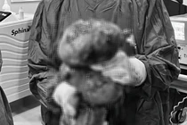 Nỗi khổ của người phụ nữ mang khối u xở tử cung to như thai 9 tháng