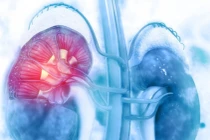 Cứu sống bệnh nhân suy thận nặng chỉ còn một quả thận