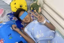 Trẻ 15 tuổi mắc sốt xuất huyết nặng, tổn thương đa cơ quan