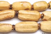 Công dụng tuyệt vời của củ sen với sức khỏe