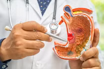 Phát hiện ung thư dạ dày di căn sau khi đi khám đầy bụng khó tiêu