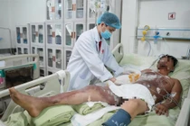 Người đàn ông Campuchia bị bỏng điện cao thế đã qua cơn nguy kịch