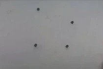 Cứu sống bé trai 6 tuổi bị thủng ruột vì nuốt 4 viên nam châm