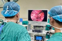 Bệnh nhân viêm ruột thừa quặt ngược sau manh tràng hiếm gặp