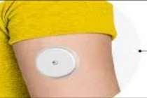 Cảnh báo từ FDA về cảm biến theo dõi đường huyết gây nguy hiểm