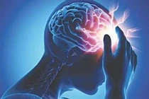 Trên thế giới, cứ 3 giây có 1 người bị đột quỵ 