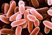 Thanh Hóa cứu sống bệnh nhân uốn ván hiếm gặp sau phẫu thuật