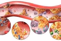 Triển vọng mới trong điều trị cholesterol cao bằng công nghệ gen