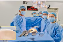 Phẫu thuật thành công khối u buồng trứng nặng 20,5 kg