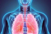 Châu Âu cấp phép thuốc mới điều trị bệnh phổi mạn tính