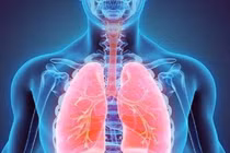 Châu Âu cấp phép thuốc mới điều trị bệnh phổi mạn tính