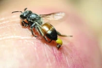 Chữa trị thành công người già bị ong đốt nguy kịch tại Phú Thọ