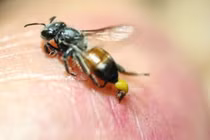 Chữa trị thành công người già bị ong đốt nguy kịch tại Phú Thọ