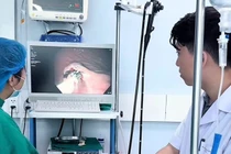 Người đàn ông phát hiện khối u mô đệm dạ dày hiếm gặp