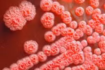 Bệnh Whitmore làm 23 người tử vong tại Thái Lan, Bộ Y tế khuyến cáo gì?