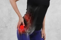 Cách nhận biết, điều trị đau thần kinh tọa hiệu quả