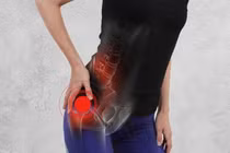 Cách nhận biết, điều trị đau thần kinh tọa hiệu quả