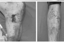 Nguy cơ chết người từ thói quen dùng điện thoại khi sạc của giới trẻ