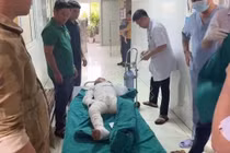 Dùng xăng đốt kiến, hai cháu nhỏ bị bỏng nặng