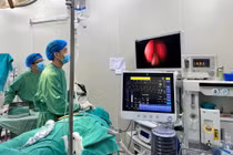 Chẩn đoán sớm giúp tránh biến chứng nguy hiểm của răng lệch vào xoang hàm