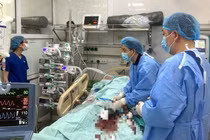 Cứu sống người đàn ông nhồi máu cơ tim cấp, ngừng tuần hoàn