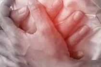 Phẫu thuật thành công cho nam bệnh nhân 44 tuổi bị nhồi máu cơ tim cấp