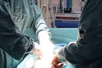 Điều trị thành công ung thư buồng trứng hiếm gặp ở trẻ em