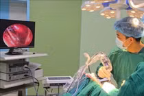 Điều trị máu tụ dưới màng cứng bằng phẫu thuật nội soi hiện đại