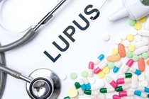 Sốt kéo dài không đáp ứng điều trị, dấu hiệu cảnh báo bệnh tự miễn hiếm gặp