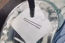 Bé trai 4 tuổi nuốt kẹp tóc kim loại, được cấp cứu thành công tại Bắc Ninh