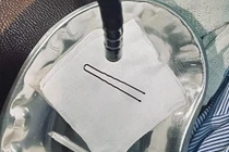 Bé trai 4 tuổi nuốt kẹp tóc kim loại, được cấp cứu thành công tại Bắc Ninh