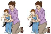 Phẫu thuật thành công lấy dị vật đường thở cho bé trai 4 tuổi