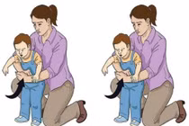 Phẫu thuật thành công lấy dị vật đường thở cho bé trai 4 tuổi