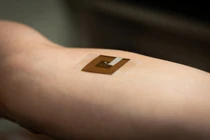 Phát minh mới, miếng dán phát hiện ung thư da không xâm lấn