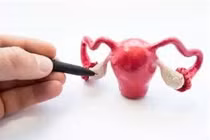 U nang buồng trứng xoắn đe dọa tính mạng bé gái 14 tuổi