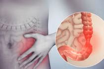 Chế độ dinh dưỡng, lối sống giúp kiểm soát hội chứng ruột kích thích