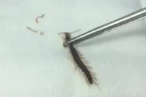 Bé trai ngủ trên nền nhà bị rết chui vào tai