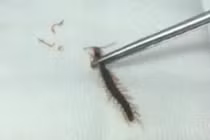 Bé trai ngủ trên nền nhà bị rết chui vào tai