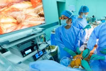 Kỹ thuật nội soi 3D hỗ trợ phẫu thuật tim cho người tiền sử xạ trị ngực