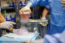 Người đàn ông Mỹ phá kỷ lục sống lâu nhất sau khi ghép thận heo