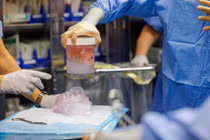 Người đàn ông Mỹ phá kỷ lục sống lâu nhất sau khi ghép thận heo