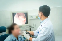 Suýt tắc đường thở vì ngậm vitamin C sủi chữa hóc xương cá